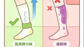 科普｜医用弹力袜≠网红瘦腿袜，哪些人群适合穿戴弹力袜？