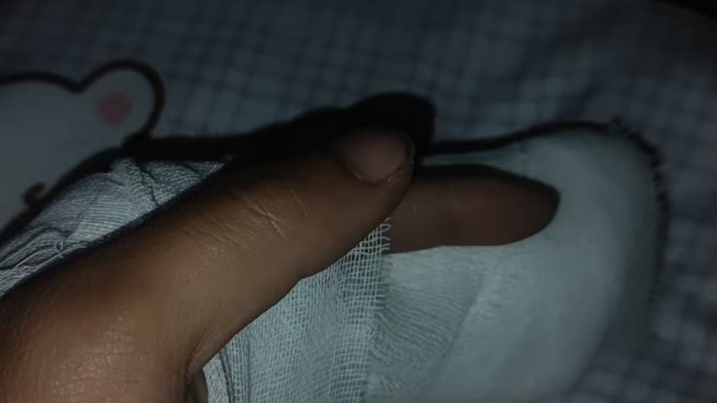 运维员反映电柜倾倒压折手指申请工伤受阻,公司:由专人答复记者