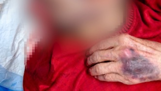 南昌一高龄老人与智力低下老人同住养老院期间疑似发生肢体冲突，多方介入处置