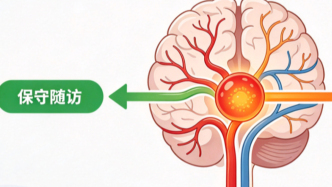 动脉瘤一定要手术吗？查出后先别慌，关键看这几点