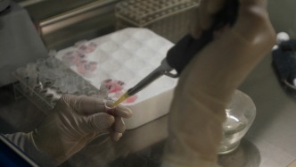 人类干细胞培育的垂体组织成功移植到灵长类动物，重新恢复关键激素信号