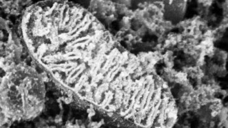 科学家绘制高精度线粒体蛋白质图谱