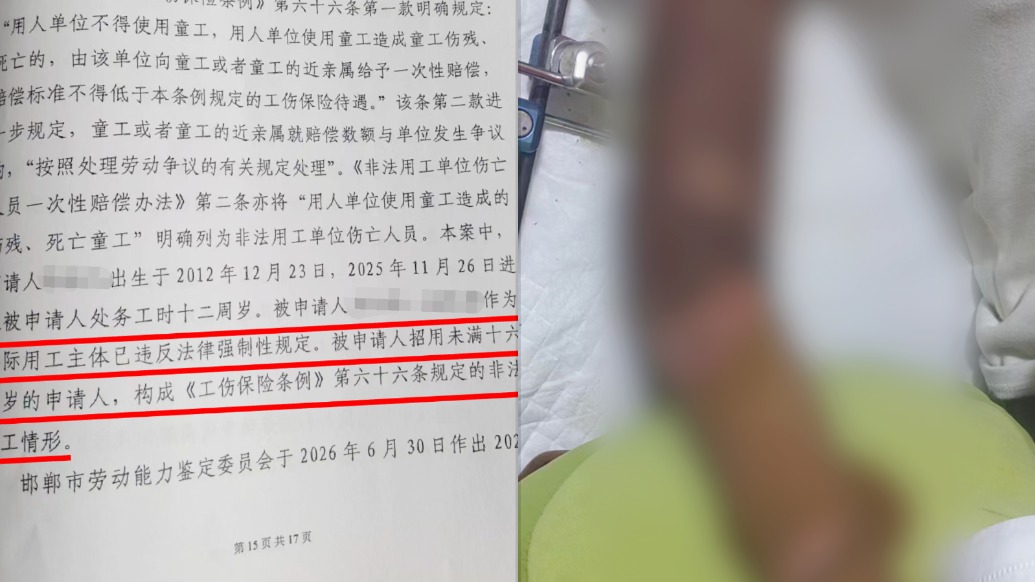12岁女童在作坊务工时成六级伤残,仲裁委:雇主招用童工构成非法用工