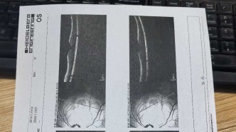 天津一教师被指用激光笔照伤学生眼睛，法院一审判学校赔偿2300余元