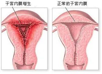 做过人流的宫颈口图片