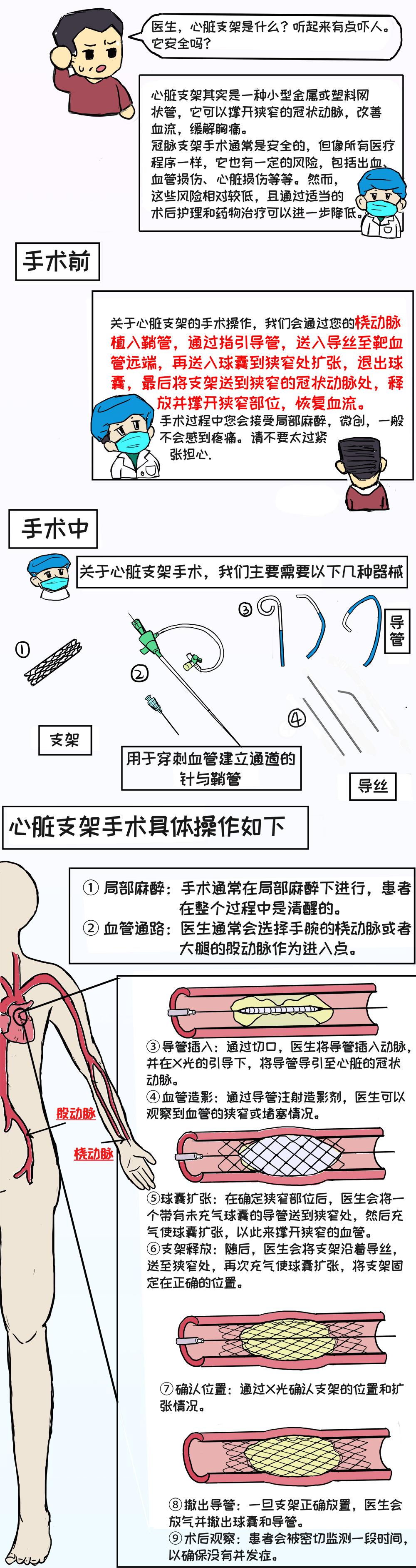 心脏支架从哪里放进去图片