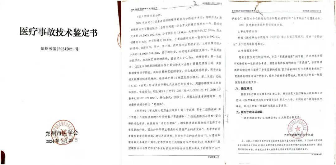 79岁老人患慢性胃炎,郑大一附院被指按胃癌晚期切除全胃