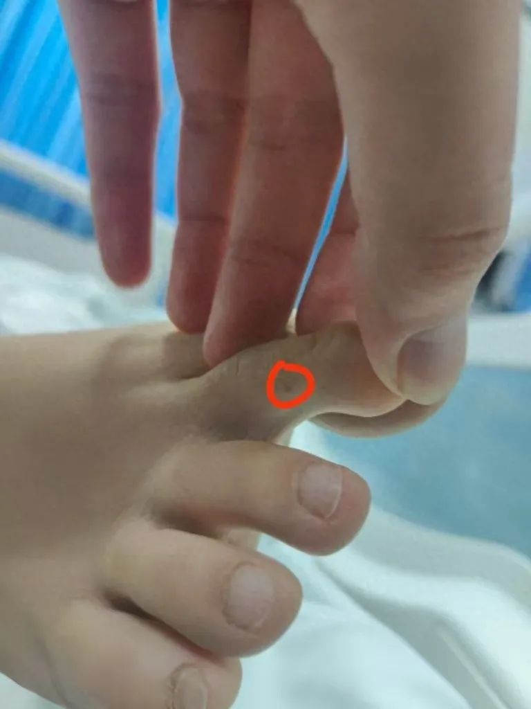 女子在三亚被咬伤身亡，三亚卫健委回应抗蛇毒血清配备问题