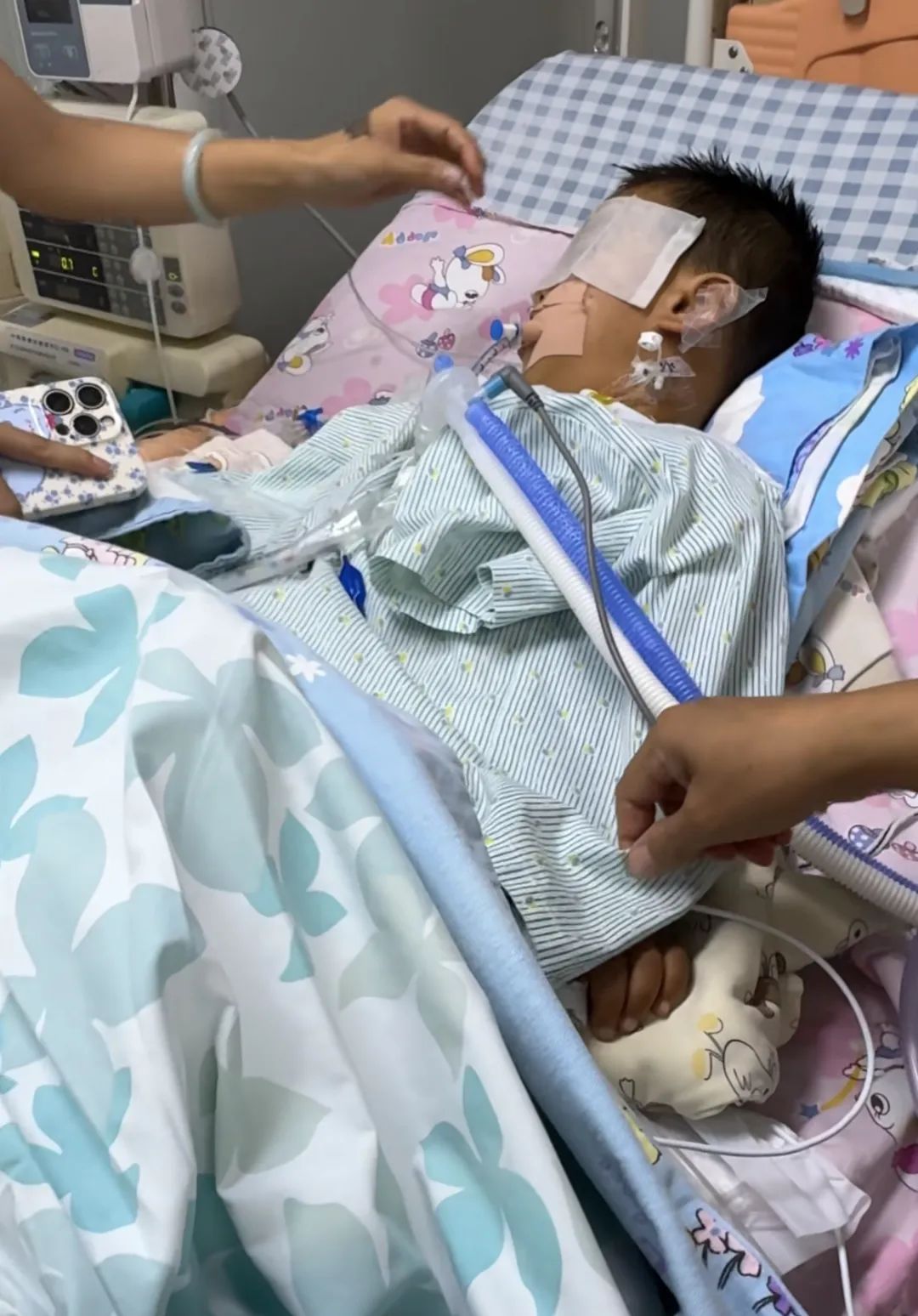 湛江3岁男童扁桃体手术后脑死亡，母亲：医院称手术监控已被覆盖看不了