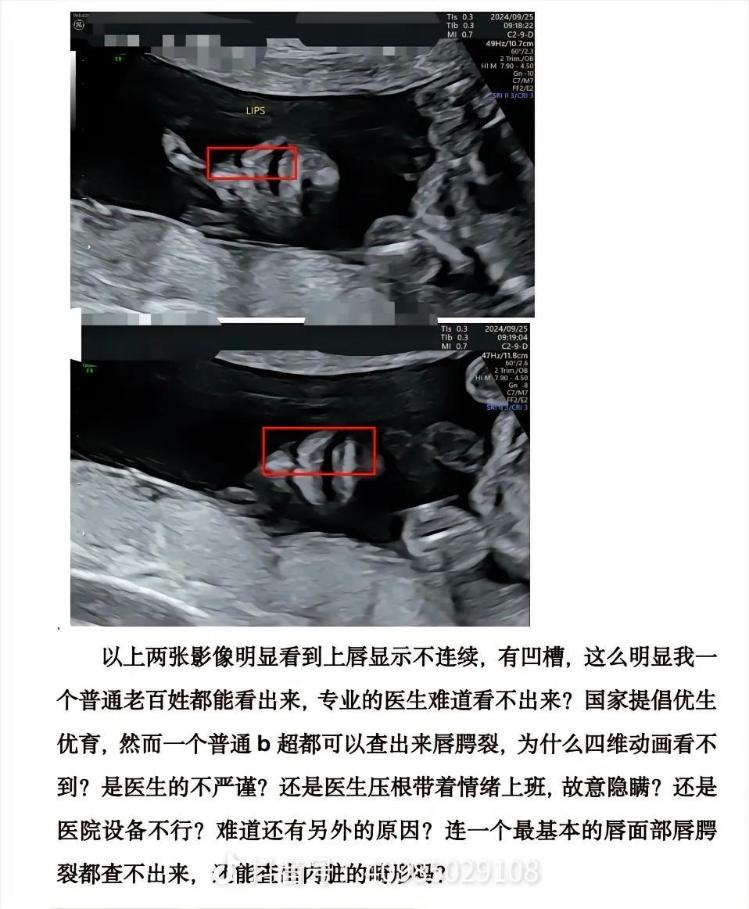 桂林女子称彩超漏诊婴儿唇裂，到卫健委反映遭怒斥，医院：未看出任何问题