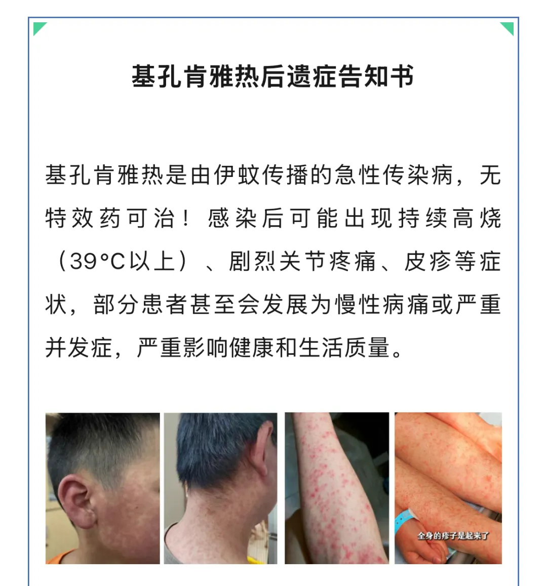 基孔肯雅热“后遗症”到底怎么回事？如何预防？专家解答