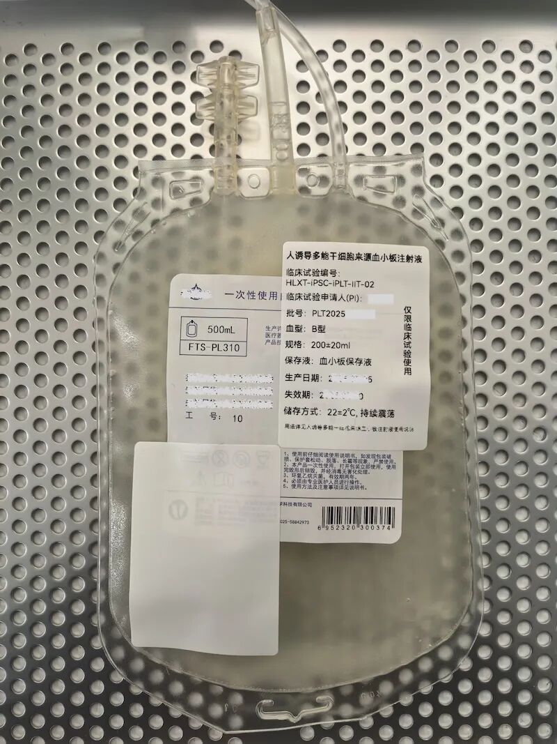 全球首个同种异体人工再生血小板临床研究取得成功，首批3例患者输注