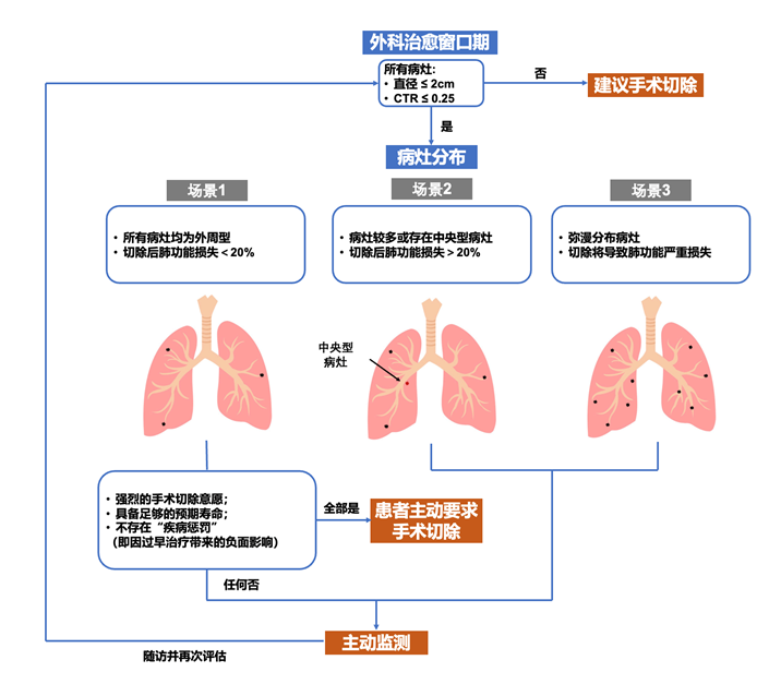 原发早期肺癌是否需要立刻手术？上海专家在权威期刊发表最新研究