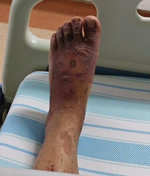 野蛮生长的荒野求生:有人提前找荒山“实习”,有人烫伤数日未被发现 3 ab24d436 b5d5 4f56 9ca2 8bd62fd4c0d5