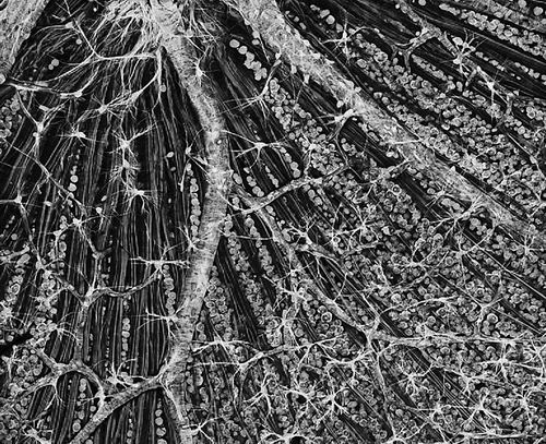 全球首例！细胞“年轻化”疗法启动人体试验用重编程治疗青光眼
