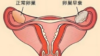 卵巢功能好不好主要看這幾項