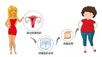 卵巢组织冻存可以带来哪些获益？