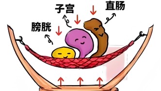 盆底康复：手术外的另一条康复路