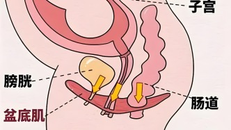 冬季寒冷，警惕子宫脱垂加重的“隐形危机”
