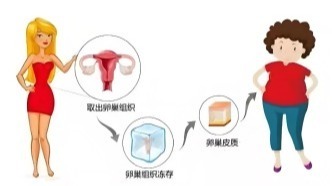 接触性出血半年，确诊癌症！她因此失去子宫、冷冻卵巢
