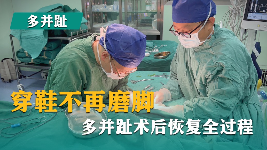 穿鞋不再磨腳,多并趾術后恢復全過程