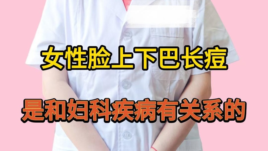 婦科夏亦冬：下巴長痘和婦科病有關(guān)嗎？