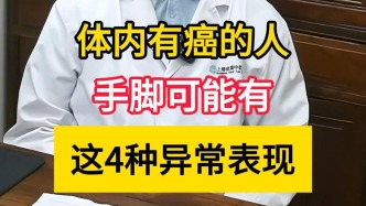 腫瘤黃建華：體內有癌的人手腳或有這些異常