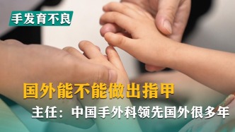 國外能不能做出指甲，主任：中國手外科領先國外很多年