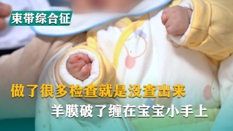 做了很多檢查就是沒查出來，羊膜破了纏在寶寶小手上