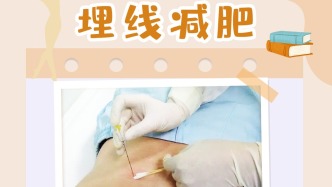 什么是埋線減肥？