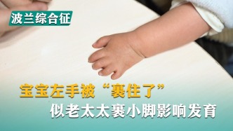 寶寶左手被“裹住了”，似老太太裹小腳影響發(fā)育