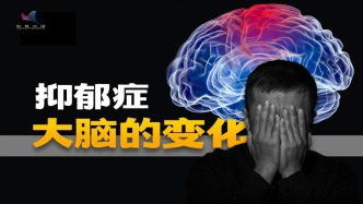 抑郁癥患者的大腦會變形？新研究為靶向干預(yù)提供可能性