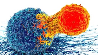 Nature子刊：异体NK细胞可精准清除癌前细胞