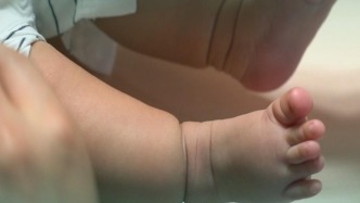 误把肥胖当成束带缠绕，主任安抚焦虑妈妈