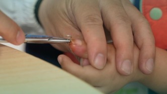 拔克氏針疼得汗都出來了吧，小孩哥：不是，我是熱的