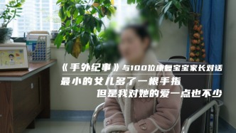 最小的女兒多了一根手指，但是我對她的愛一點也不少