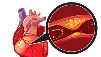夏季警惕心臟發(fā)出的6大“求救信號”