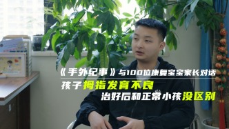 孩子拇指發育不良，治好后和正常小孩沒區別