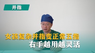 并指免植皮 | 第31集《女孩复杂并指变正常五指，右手越用越灵活》