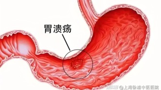 胃病是怎么出現(xiàn)的？