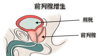 前列腺的秘密日记：写给主人的健康警报书
