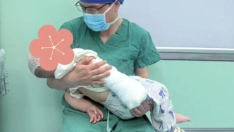 鄭州市一院兒童燒傷治療告別“撕心裂肺”時代