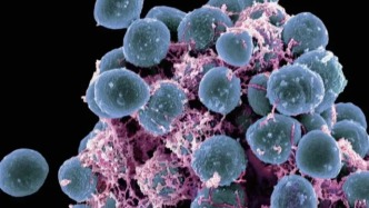 微生物也有“社區(qū)”？揭開生物被膜的神秘面紗 | 科學(xué)世界·視點(diǎn)