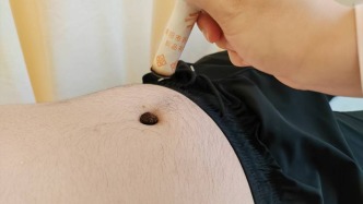 化疗胃肠病  治疗在“脐”中