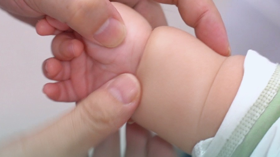 寶寶胳膊被懷疑是束帶，疑似都算不上，就是肥胖