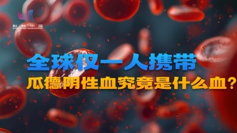 全球仅一人携带！瓜德阴性血和ABO型血有什么不同？