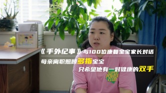 手外紀(jì)事 | 母親離職照顧多指寶寶，只希望他有一對健康的雙手