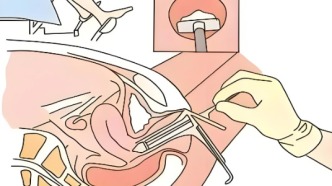 科普 | 讀懂婦科檢查：聚焦3項關鍵項目，幫你掌握健康主動權，避開篩查誤區