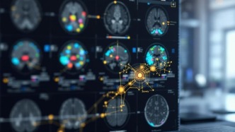 斯坦福大学利用AI合成数据绘制大脑奥秘