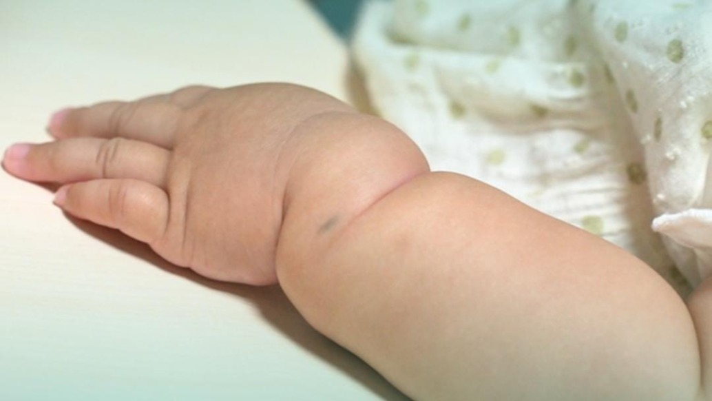 每周都有幾個來看束帶的小胖,不是束帶你非要挨一刀干啥